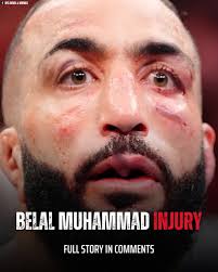 Just one title defense and they do him like this! 😶 #combatsports #mma  #ufcnews #mmanews #jackdellamaddalena #ufc315