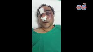 التلفزيون الحكومي في إيران يبث صورة لرجل قال إنه كان وراء الهجوم الأخير على منشأة نطنز النووية، ولم كانت تكلفة المشاركة العسكرية والأمنية في أفغانستان التي استمرت 20 عاما باهظة في حلقة اليوم نتعرف على طرق تدوير فضلات الأكل بتحويله إلى منتجات أخرى. Ø£Ø®Ø¨Ø§Ø± Ø§Ù„ÙŠÙˆÙ… Ø§ÙˆÙ„ ÙÙŠØ¯ÙŠÙˆ Ù„Ù„Ù…ÙˆØ§Ø·Ù† Ø§Ù„Ù…ØµØ±ÙŠ Ø§Ù„Ù…Ø¹ØªØ¯Ù‰ Ø¹Ù„ÙŠÙ‡ ÙÙŠ Ø§Ù„ÙƒÙˆÙŠØª Youtube
