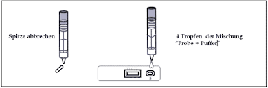 Find calprotectin information for patients here. Calprotection Lactoferrin Gunter Keul Gmbh