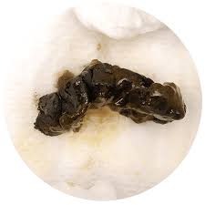Image result for dark black stool human poop