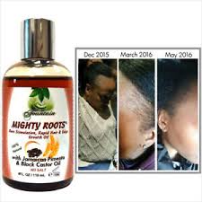 Promote healthy hair with the reparative omegas of jamaican black castor oil. Receding Hairline Or Thin Hair Growth Oil With Jamaican Pimento Black Castor Oil 793283499523 Ebay
