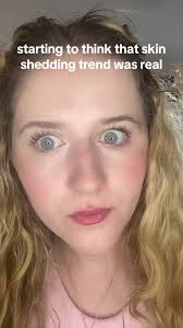 am i just a late bloomer? #skinshed #skinshedding #sheddingskin  #sheddingprank #skin #breakout #skin #prank #viral #trending #dailyshed  #monthlyshed