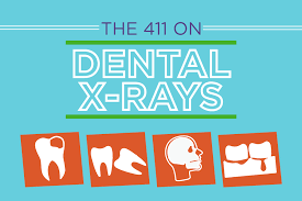 Check out this guide to the cost and types of dental fillings available to you. Facts About Dental X Rays Infographic Delta Dental Of Iowa