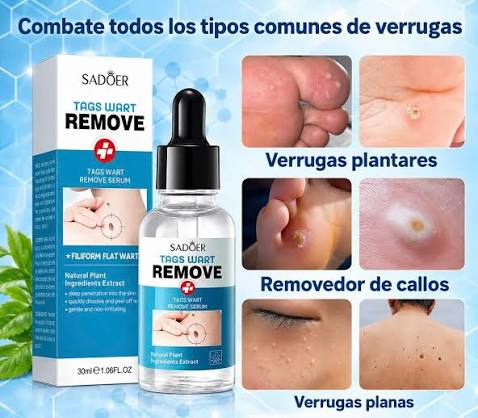 Líquido removedor de verrugas Q60!! Más envío según ubicación, pago contra  entrega