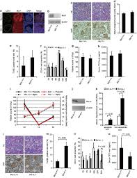Maybe you would like to learn more about one of these? Mcl 1 And Bcl Xl Regulate Bak Bax Dependent Apoptosis Of The Megakaryocytic Lineage At Multistages Cell Death Differentiation