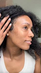 Meet the first ever skin volumizing treatment formulated specifically for  GLP-1 users. Created to restore firmness, elasticity, and volume-without  surgery.