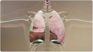 Image result for Parapneumonic Effusion