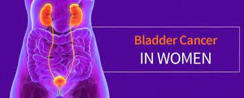 Bladder cancer can be cured when detected and treated early. What To Know About Bladder Cancer In Women Cxbladder
