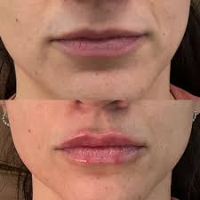 Injector Artist by Heather DeRoche