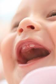 Le Estan Saliendo Los Dientes A Mi Bebe Enfamilia