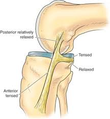 We put a shaver and a punch in and trimmed down the medial meniscus. Anatomy Musculoskeletal Key