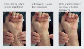 Klinische Untersuchungen Der Durchblutung