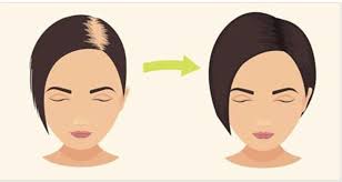 Prima di tutto, il bicarbonato aiuta a mantenere equilibrato il ph dei capelli, . Bicarbonato Di Sodio Salvezza Per I Capelli Ecco Perche