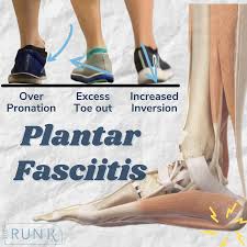 Image result for Running Injury