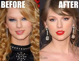 It could be seen from the before and after pictures. Taylor Swift Plastic Surgery Mystery Solved