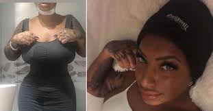 Hon åkte till Turkiet för plastikkirurgi