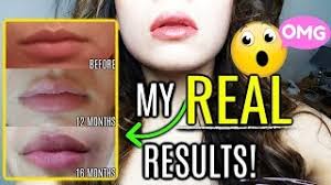 In order to get your lips plumped, you have to prep them. How To Get Bigger Lips Permanently Without Surgery Follow 7 Steps