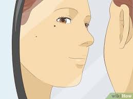 Most people have 10 to 40 moles, some of which may change in appearance or fade away over time. How To Get Rid Of Moles On Your Face With Pictures Wikihow