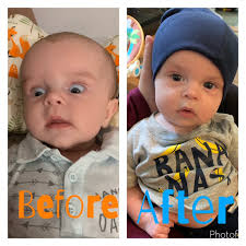 Baby's Head Was Too Large Mom Worried. It Was Brain Tumor