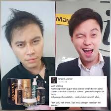 Namun setelah bersalin beberapa bulan, semakin banyak rambut melekat pada sikat jawapan rambut gugur selepas bersalin adalah normal. Feedback Pengguna Prg Rambut Pernah Gugur Teruk Sekarang Alhamdulilah Rambut Dah Kembali Sihat Ada Banyak Lagi Testimoni Instagram Posts Instagram Cara