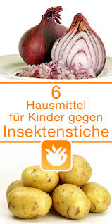 Kartoffelauflage Zaubernusslotion Mckenstichpaste Insektenstichen Zwiebelauflage Quarkkompresse Insektenstiche Essigumschlag Hau Hausmittel Kids