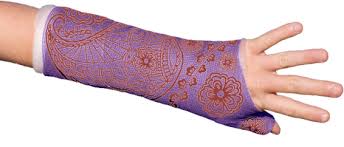 The cast would go from the knuckles to the upper. Blog Latest News About Orthotape Medical Products News 2018 10