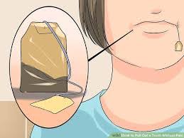 Maybe you would like to learn more about one of these? Pull Out A Tooth Without Pain