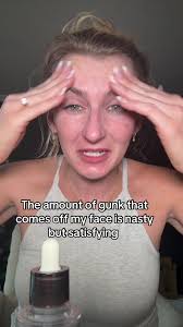 Doctor Alex Peel Shot Review: Transform Your Skin