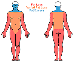 Image result for Lipodystrophy