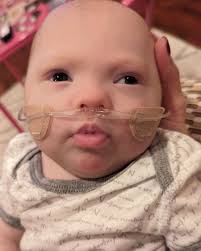 Fundraiser by johanna Laykoff : Help Vaughn Thrive: A Call for Support