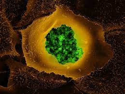 Chlamydia Can Live In Your Gut And Reinfect You After You Re Cured Smart News Smithsonian Magazine