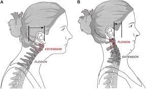 The transducer attachment arm was adjusted so the head touched the the researchers found a significant difference in the neck extension strength between patients with tth and controls (17.07 vs 21.49 nm [a. References In The Assessment Of The Cervical Spine Part 1 Range Of Motion And Proprioception Journal Of Bodywork And Movement Therapies
