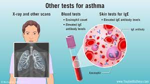 Pin On Asthma