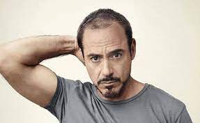 No matter how hard these actors, their hair loss specialists and their 'glam squad' teams of hair and makeup artists. 45 Best And Worst Celebrity Hair Transplant Procedures