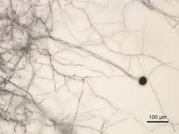 Aspergillus niger can even grow in environments with very little nutrients available. Schwarzer Giesskannenschimmel Wikipedia