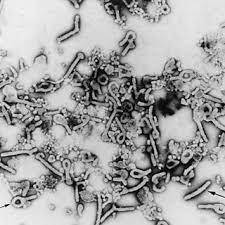 Experts suspect that both viruses people who have ebola virus or marburg virus typically don't become contagious until they develop symptoms. A B Electron Microscopic Appearance Of Marburg Virus Stained By Download Scientific Diagram
