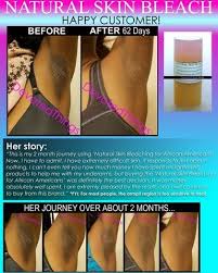 Natural Skin Bleaching Cream For African Americans White Devotedthings Skin Bleaching Skin Bleaching Cream American Skin