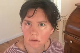 Fundraiser by Jessica Foutch : Rehab for Jessica