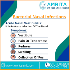 A vestibule is an entrance to, such as the entrance to your house, or in medical terms it may be the entrance to the ear (auricular vestibule), the mouth (oral vestibule), the nose (nasal vestibule), etc. Bacterial Nasal Infection Symptoms Nasal Infection Hospital Head And Neck