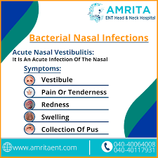 Hermawan surya d moderator : Bacterial Nasal Infection Symptoms Nasal Infection Hospital Head And Neck