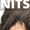 Head lice can be white, brown, or dark gray. 1