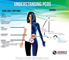 Pin By Rachelle Taylor On Pcos Pcos Polycystic Ovary Syndrome Pcos Polycystic Ovarian Syndrome