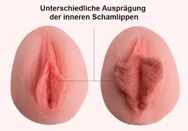 Februar 2011 um 14:15 hallo mein name ist 16 und habe zu große innere schamlippen ich kann morgens erst um 8 uhr einschlafen weil ich immer daran denken muss ob dies der fall ist oder nicht. Weibliche Geschlechtsorgane Dollpark Gmbh