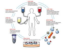 It may be recommended when at least two other treatments have not been effective. The Car T Cell Revolution What Does It Offer And Can We Afford It Cancer World Archive