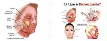 By removing these fat pads, the face takes on a more attractive look and a better profile. Bichectomia What Kind Of Thing Is This Daniela Christoffer