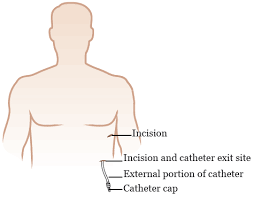 Image result for Pleiotaxis