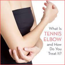 If you have tennis elbow, you will likely feel burning or pain at the outside of the elbow and you'll likely have difficulty making a fist or gripping things. What Is Tennis Elbow And How Do You Treat It