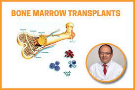 If your doctor needs more info, he'll. Bone Marrow Transplant A Cure For Blood Cancer