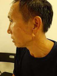 Nesten drept av broren