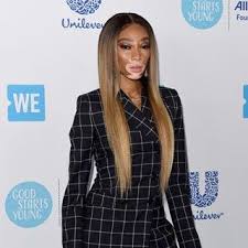 Gelbstich Entfernen 5 Sos Tipps Fur Blondiertes Haar Trend Haarfarben Schone Haarfarben Blondieren